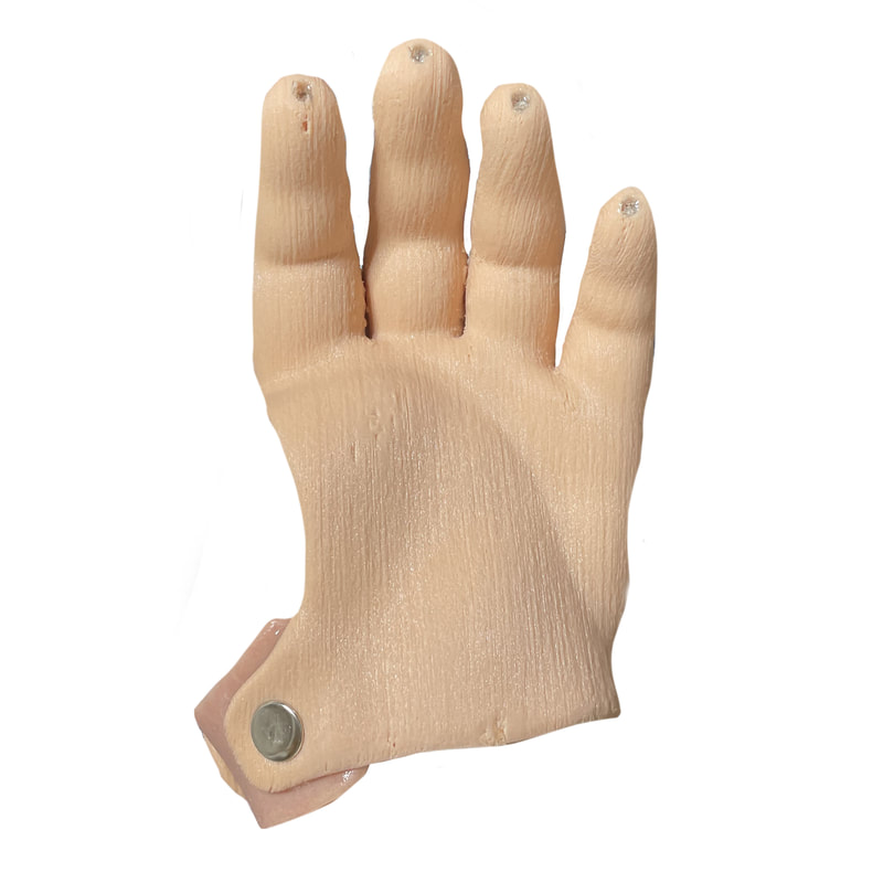 Click here to learn more about functional 3D printed hand prosthesis by Functional Restorations