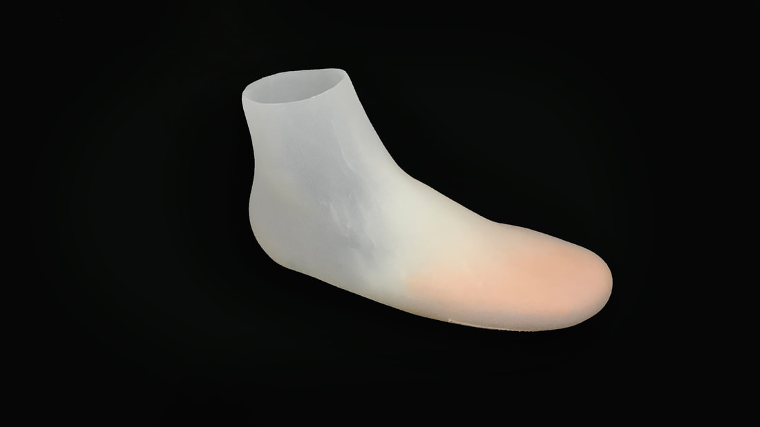 Functional Partial Foot Silicone Prosthesis Functional Restorations Durham North Carolina