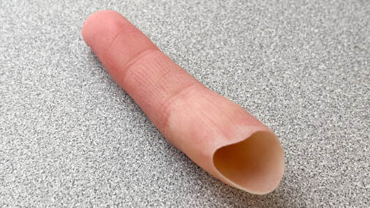 A custom silicone finger prosthesis by Functional Restorations in Durham North Carolina
