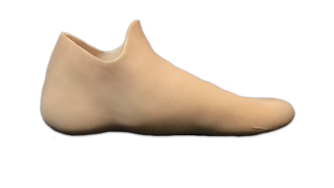 A functional custom silicone partial foot prosthesis by Functional Restorations